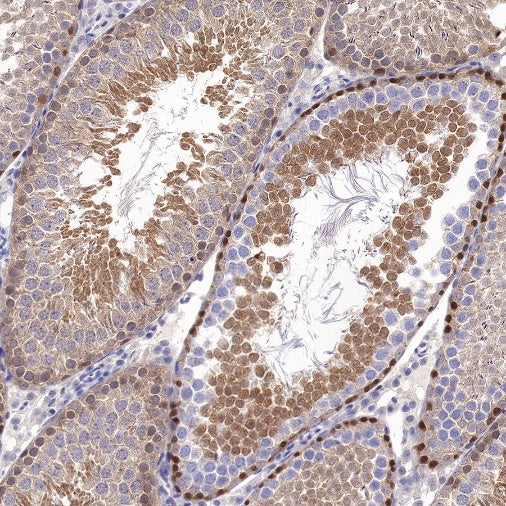 JNK1 Recombinant Rabbit mAb (S-1153-21)