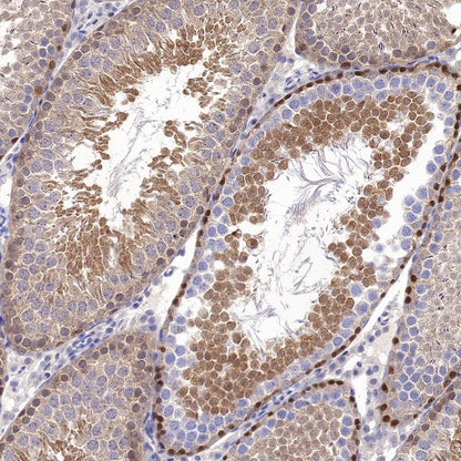 JNK1 Recombinant Rabbit mAb (S-1153-21)