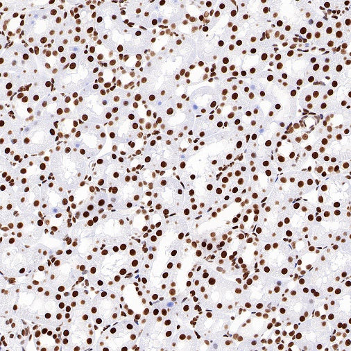 Topoisomerase I/TOP1 Recombinant Rabbit mAb (S-822-60)