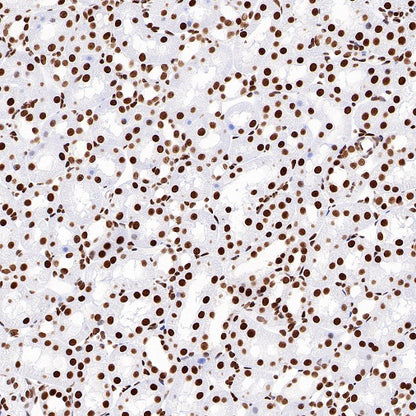 Topoisomerase I/TOP1 Recombinant Rabbit mAb (S-822-60)