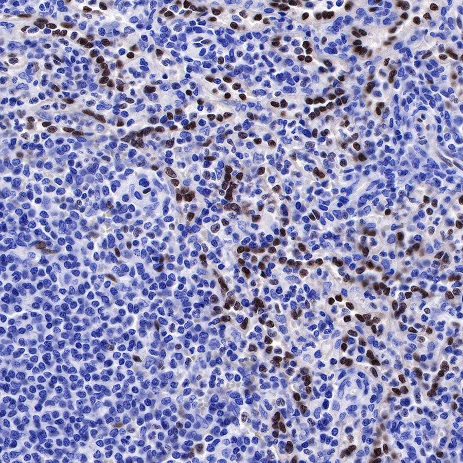 ERG Recombinant Rabbit mAb,PBS Only (SDT-190-65)