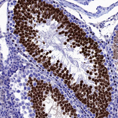 NUT Recombinant Rabbit mAb, PBS Only (SDT-3062)