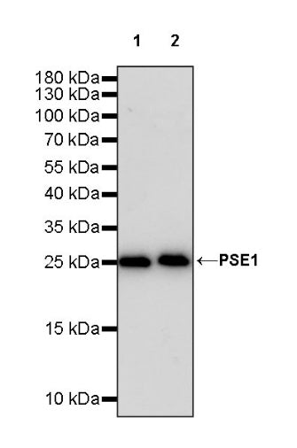 PSME1 Recombinant Rabbit mAb (S-732-14)