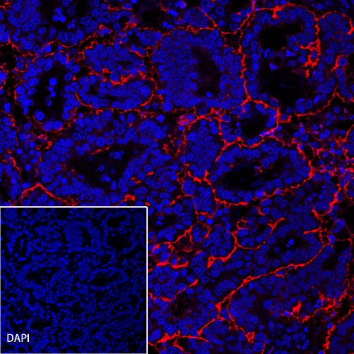 CA125 Recombinant Rabbit mAb (Alexa Fluor® 555 Conjugate) (SDT-555-41)