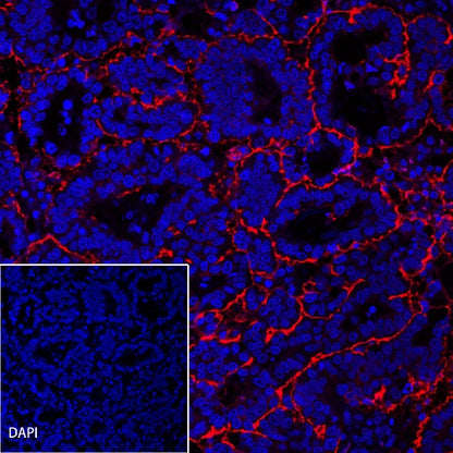 CA125 Recombinant Rabbit mAb (Alexa Fluor® 555 Conjugate) (SDT-555-41)