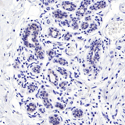 ErbB3 Recombinant Rabbit mAb (SDT-991-14)