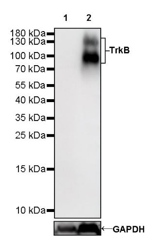 TrkB Recombinant Rabbit mAb (S-488-5)