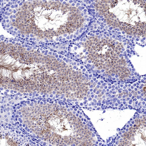 Hyaluronidase PH20/SPAM1 Recombinant Rabbit mAb (S-2143-20)