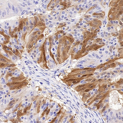 CDKN2A/p16 INK4A Recombinant Mouse mAb (SDT-4677)