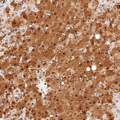 QPRT Recombinant Rabbit mAb (S-1228-31)