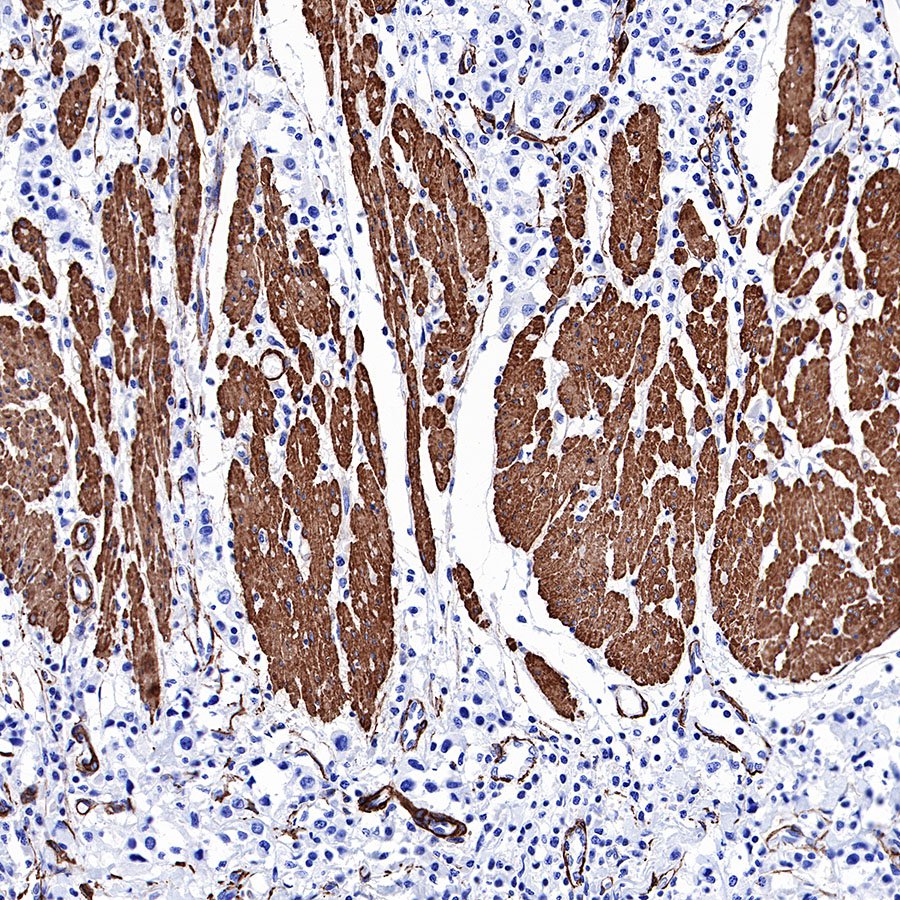 alpha smooth muscle Actin (SMA) Recombinant Rabbit mAb,PBS Only (SDT-132-63)