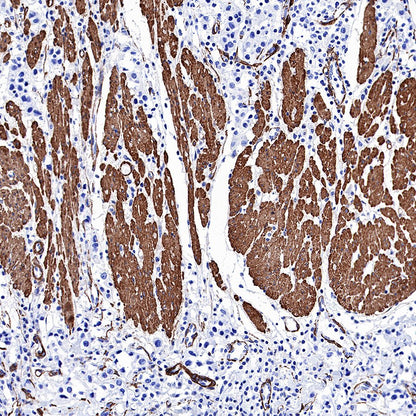 alpha smooth muscle Actin (SMA) Recombinant Rabbit mAb,PBS Only (SDT-132-63)