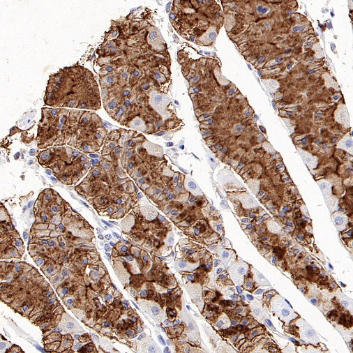 CD57 Mouse mAb (S-R571)