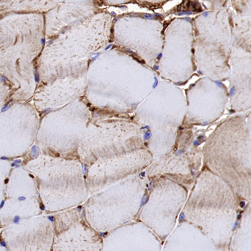 NDUFA1 Recombinant Rabbit mAb (S-1277-177)