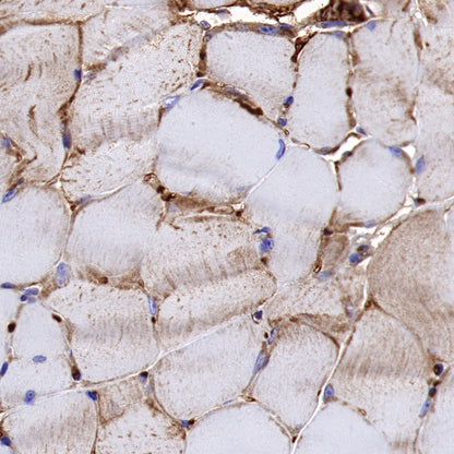 NDUFA1 Recombinant Rabbit mAb (S-1277-177)