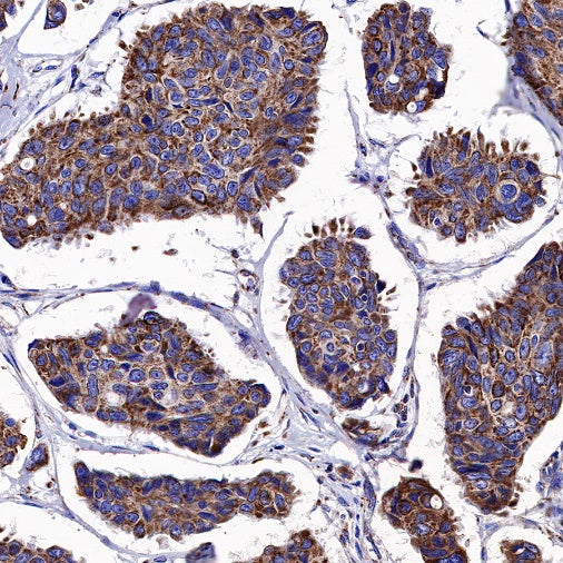 AIF Recombinant Rabbit mAb (S-948-54)