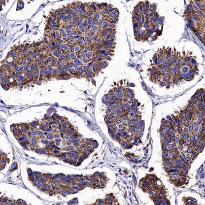 AIF Recombinant Rabbit mAb (S-948-54)