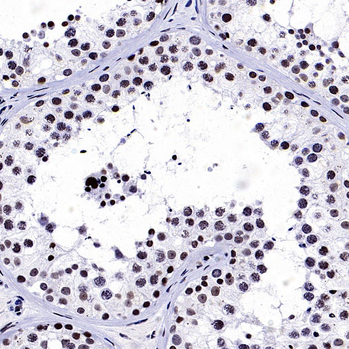 Cyclin E1 Recombinant Rabbit mAb (SDT-2512-182)