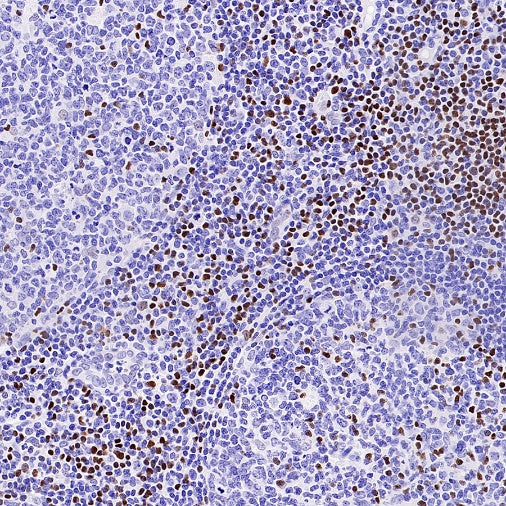 TCF1/TCF7 Recombinant Rabbit mAb (S-3486)