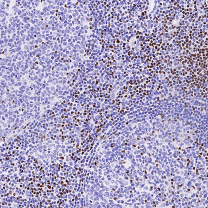 TCF1/TCF7 Recombinant Rabbit mAb (S-3486)