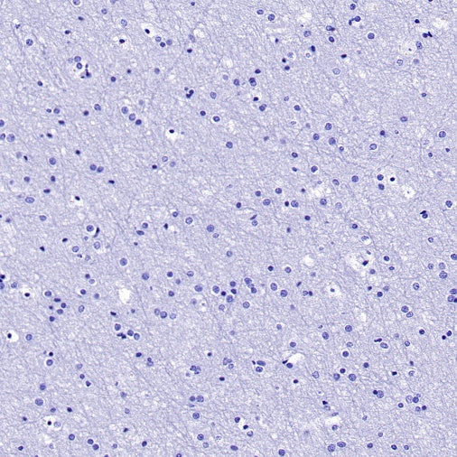 Napsin A Recombinant Rabbit mAb (SDT-2777-115)
