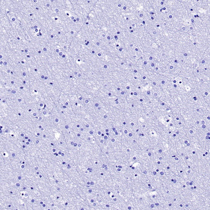 Napsin A Recombinant Rabbit mAb (SDT-2777-115)