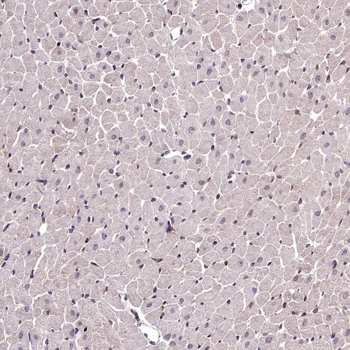 RIPK1 Rabbit Polyclonal Antibody
