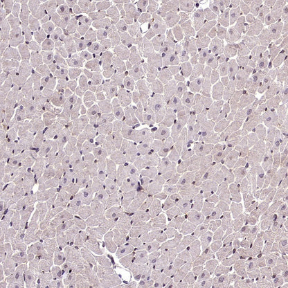 RIPK1 Rabbit Polyclonal Antibody