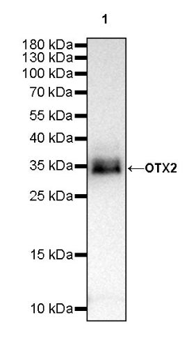 OTX2 Recombinant Rabbit mAb (S-2095-8)