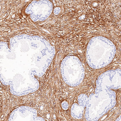 Collagen VI (COL6A1) Recombinant Rabbit mAb (S-1495-18)