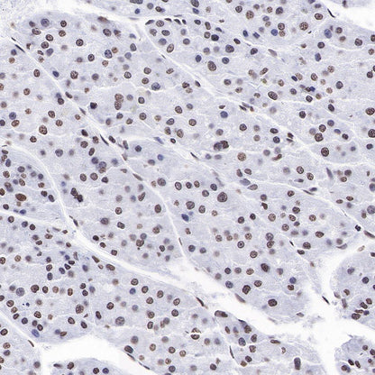 Histone H3 (mono methyl K4) Rabbit polyclonal antibody