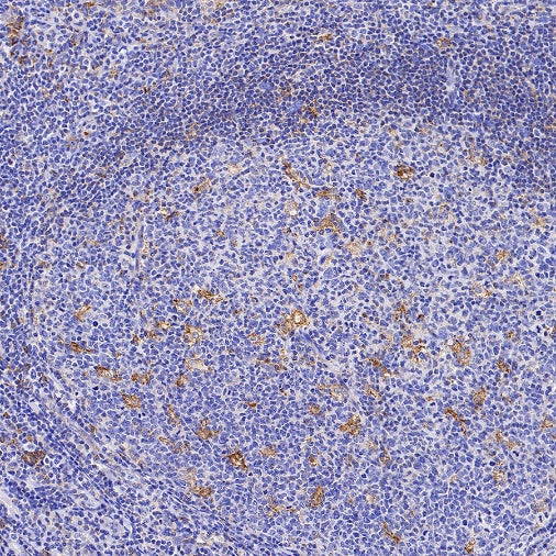 M6PR Recombinant Rabbit mAb (S-1480-21)