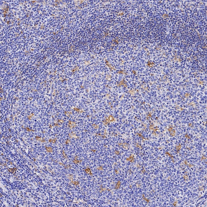 M6PR Recombinant Rabbit mAb (S-1480-21)