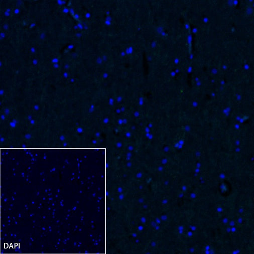 MUC5B Recombinant Rabbit mAb (SDT-2351-40)