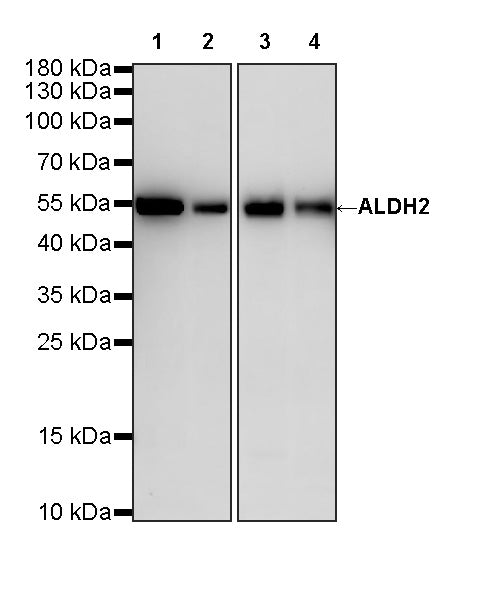 ALDH2 Recombinant Rabbit mAb (S-4173-20)