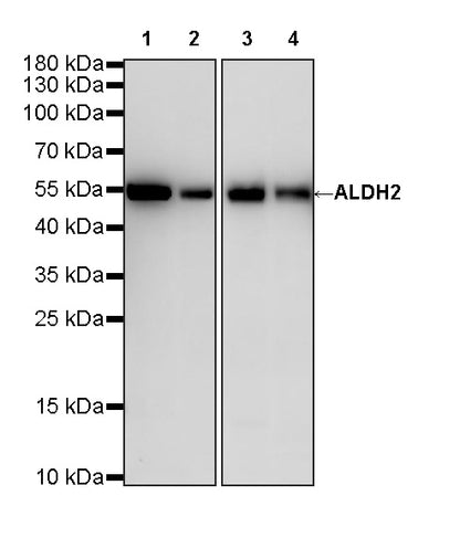 ALDH2 Recombinant Rabbit mAb (S-4173-20)