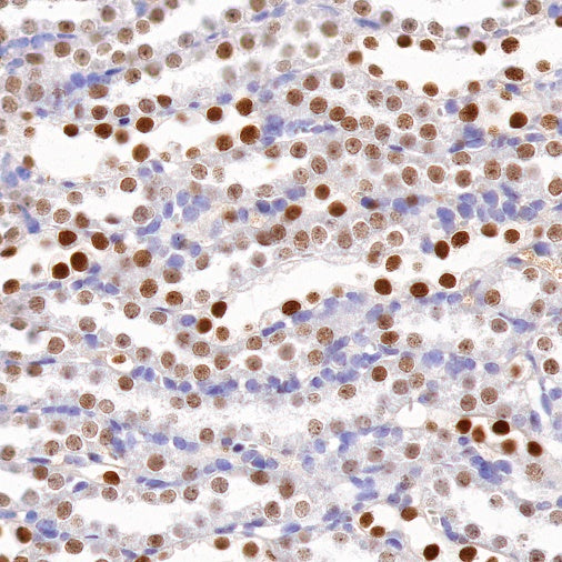 PAX8 Recombinant Rabbit mAb (SDT-R509)