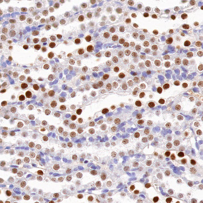 PAX8 Recombinant Rabbit mAb (SDT-R509)