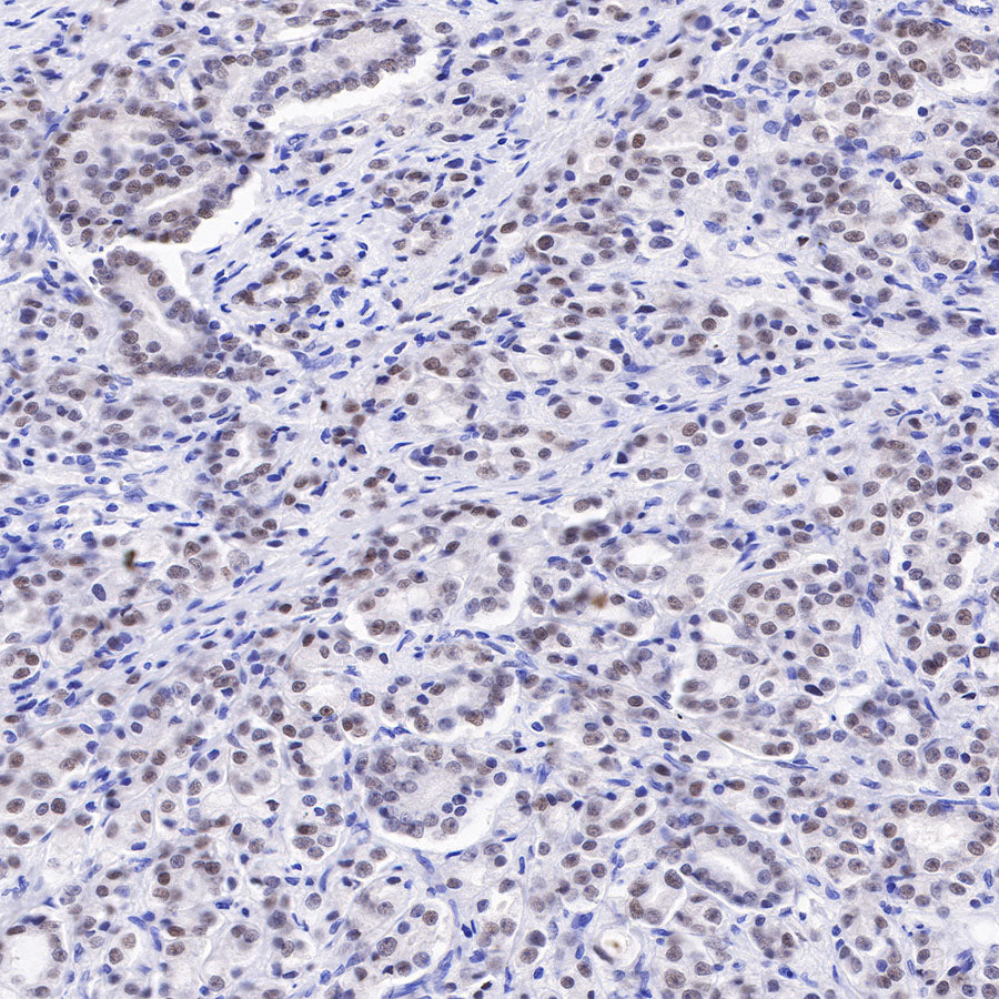 Androgen Receptor Recombinant Rabbit mAb (SDT-R167)