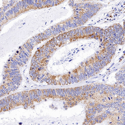 ATP5B Recombinant Rabbit mAb (S-1271-29)