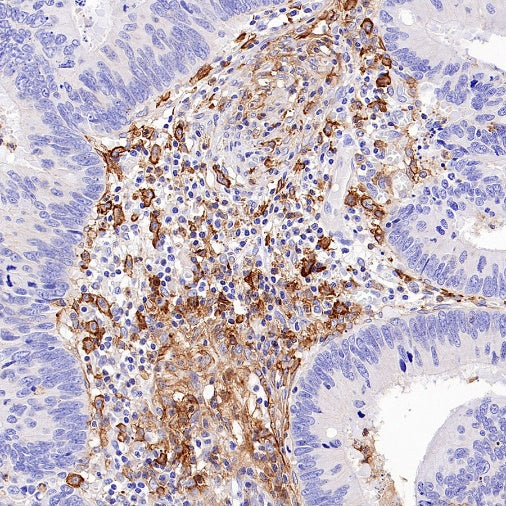 NINJ1 Recombinant Rabbit mAb (S-3109-56)