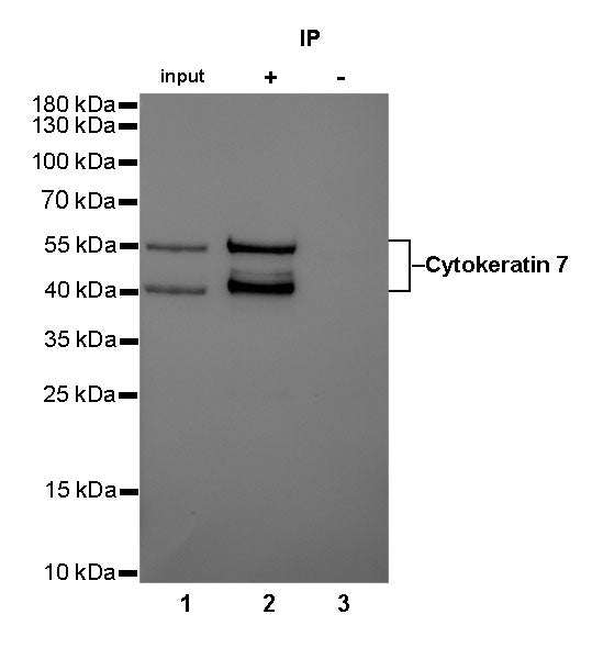 S-RMab® Cytokeratin 7 Recombinant Rabbit  mAb,PBS Only (SDT-121-17)