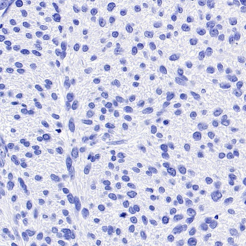 TMEM16A Recombinant Rabbit mAb (SDT-2179-12)
