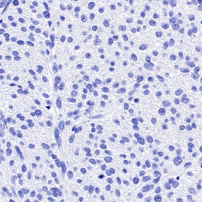 TMEM16A Recombinant Rabbit mAb (SDT-2179-12)