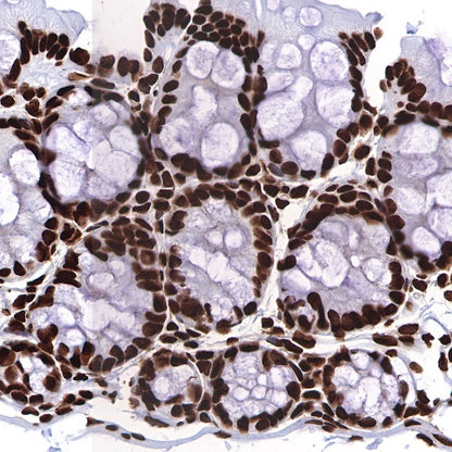 Histone H3 (acetyl K9) Rabbit polyclonal antibody