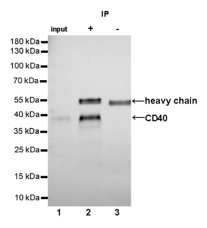 CD40 Recombinant Rabbit mAb,PBS Only (SDT-145-45)
