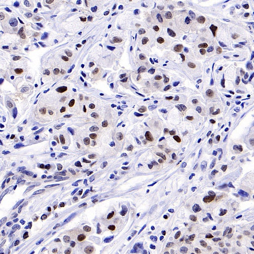 FoxO3a Recombinant Rabbit mAb (S-465-41)