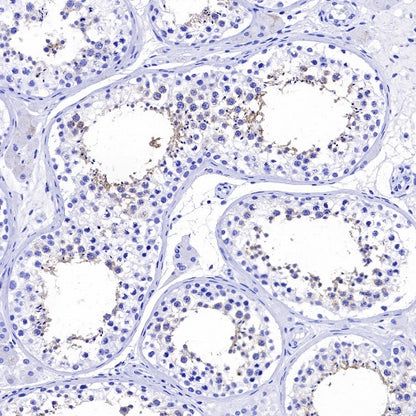 LKB1 Recombinant Rabbit mAb (S-1264-31)