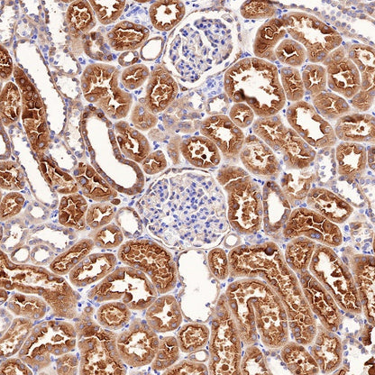 Ezrin Recombinant Rabbit mAb (S-R358)