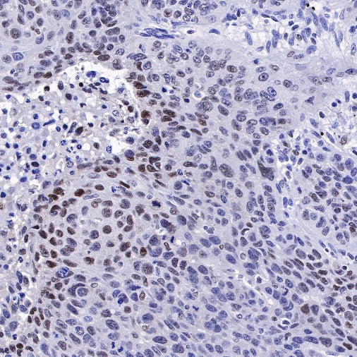 PFKFB3 Recombinant Rabbit mAb (S-653-35)